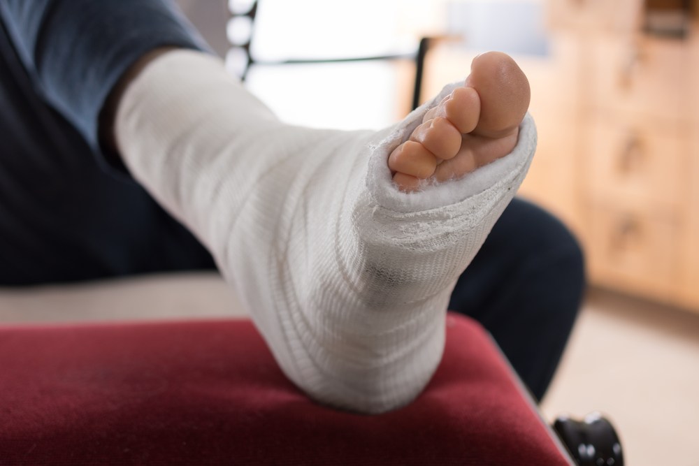 close-up on a foot in a cast