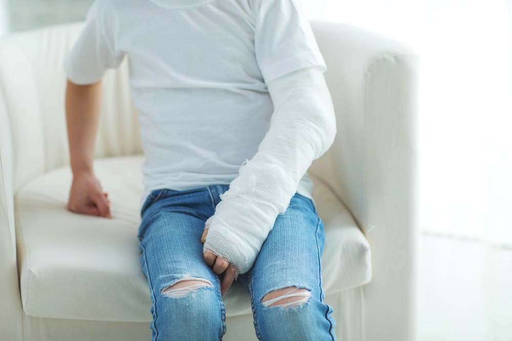 person with a full arm cast