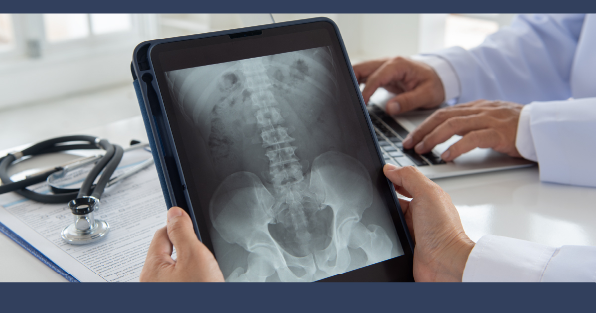 Joliet Personal Injury Lawyer
