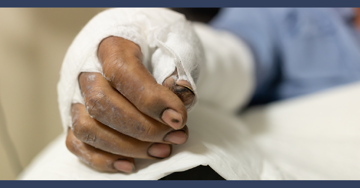 Holt Personal Injury Lawyer