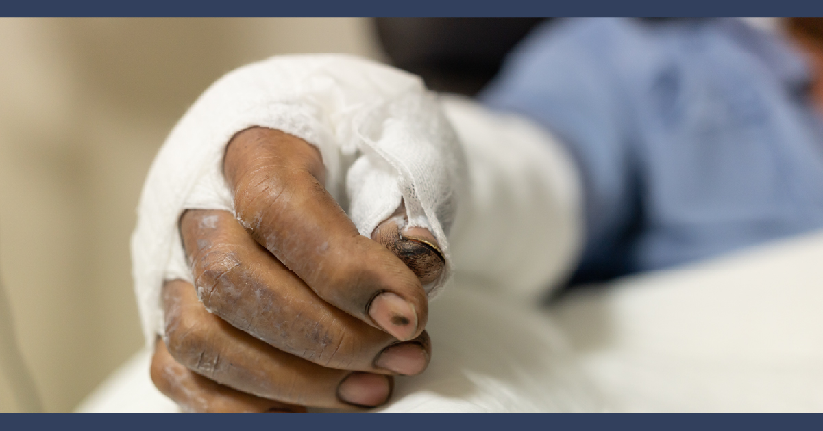 Eureka Personal Injury Lawyer
